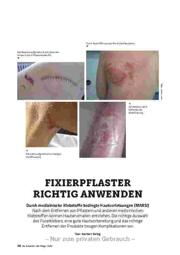 Vorschauseite 1: FIXIERPFLASTER RICHTIG ANWENDEN
