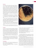 Vorschauseite 4: Cholera - weltweit immer wieder Krankheitsausbrüche