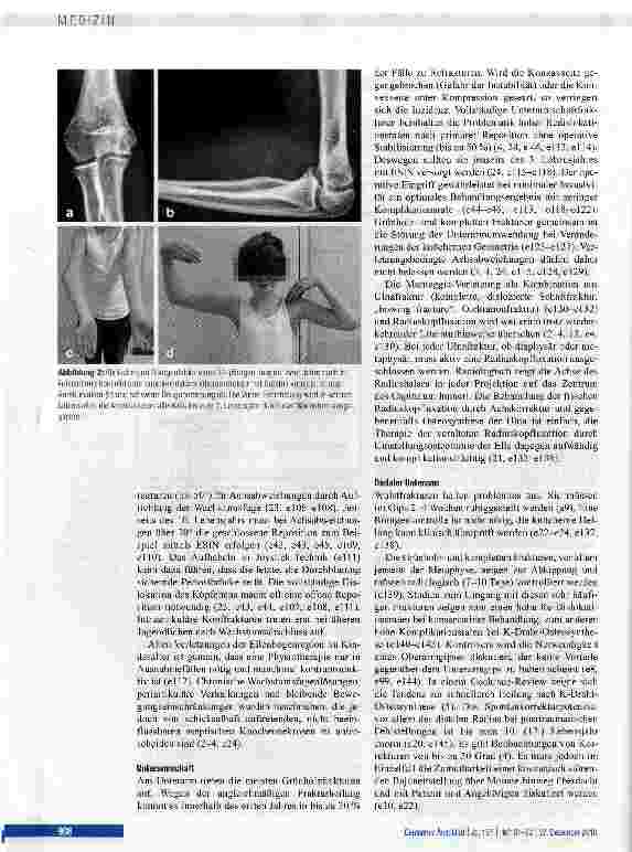 Vorschauseite 6: Frakturbehandlundlung an der oberen Extremität bei Kindern und Jugendlichen