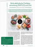 Vorschauseite 1: Nicht-alkoholische Fettlebererkrankung (NAFLD) und Zink
