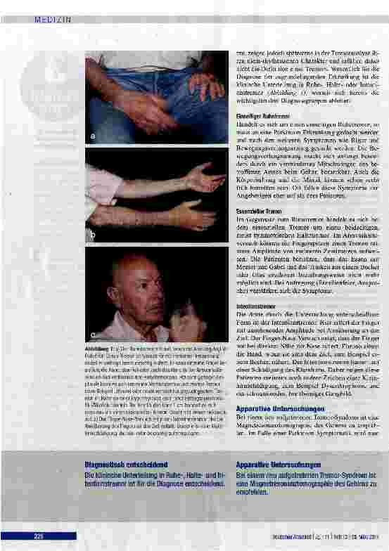 Vorschauseite 2: Differenzialdiagnose und Therapie des Tremors