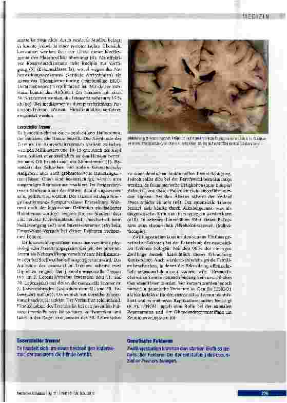 Vorschauseite 5: Differenzialdiagnose und Therapie des Tremors