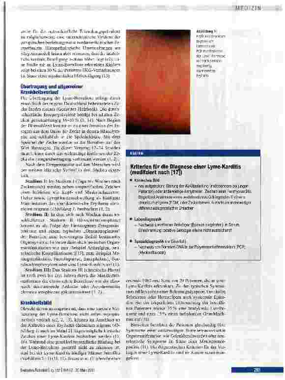 Vorschauseite 2: Diagnostik, Therapie und Prognose der Lyme-Karditis