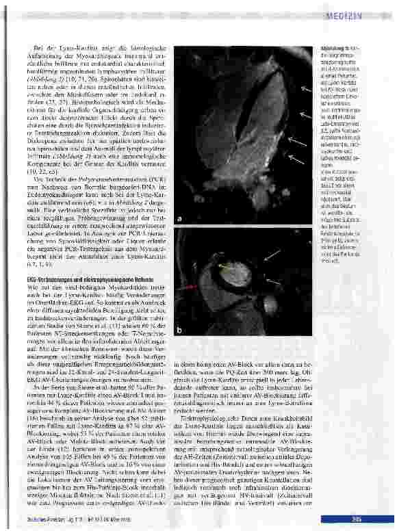 Vorschauseite 4: Diagnostik, Therapie und Prognose der Lyme-Karditis