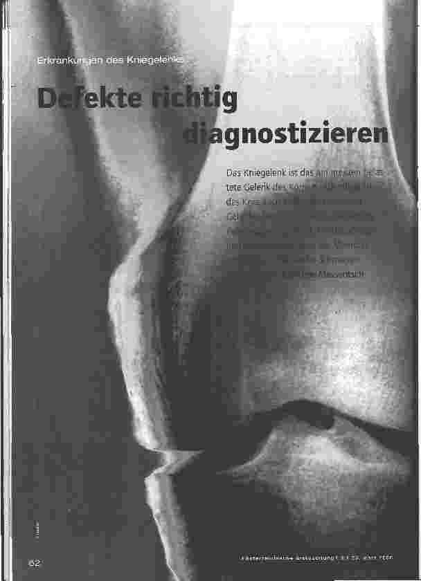 Vorschauseite 1: Erkrankungen des Kniegelenks - Defekte richtig diagnostizieren