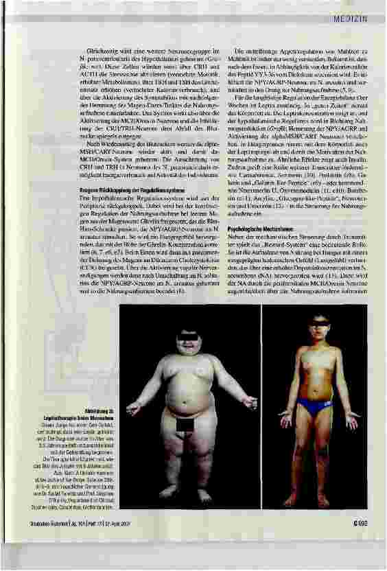 Vorschauseite 3: Adipositas - Eine Einführung in molekulare Mechanismen
