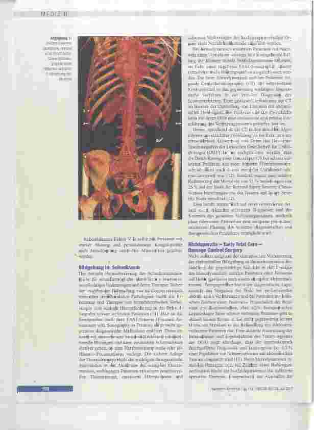 Vorschauseite 4: Polytrauma und Schockraummanagement