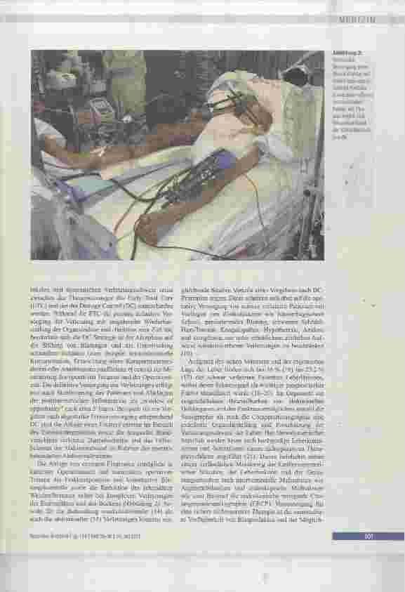 Vorschauseite 5: Polytrauma und Schockraummanagement