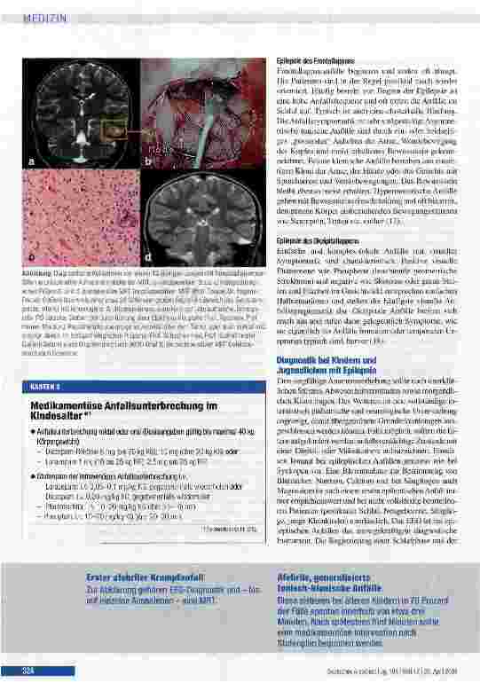 Vorschauseite 6: Epilepsie im Kindesund Jugendalter