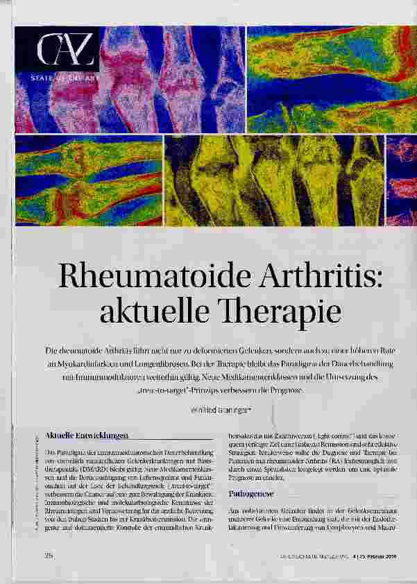 Vorschauseite 1: Rheumatoide Arthritis: aktuelle Therapie