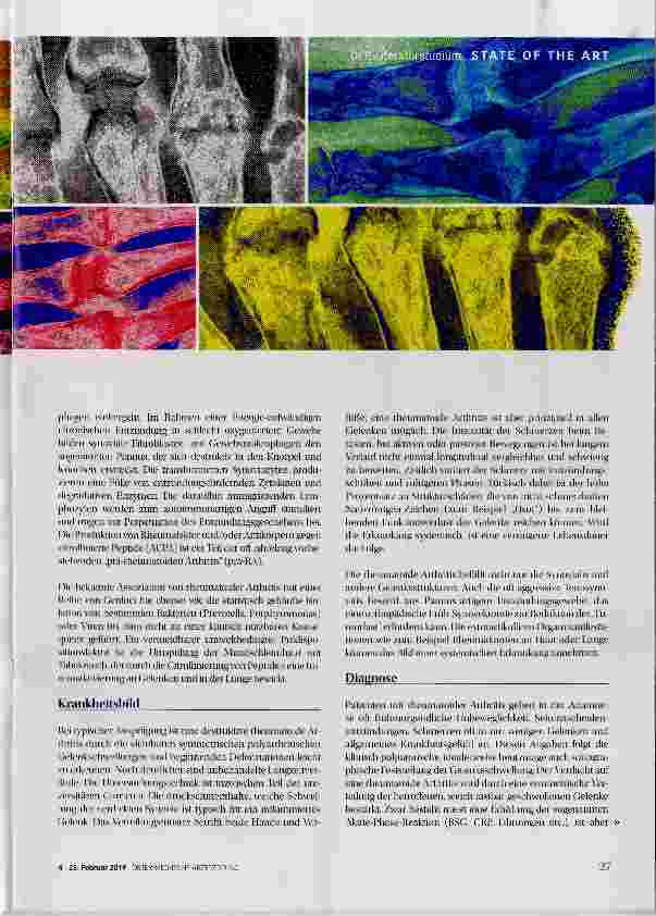 Vorschauseite 2: Rheumatoide Arthritis: aktuelle Therapie