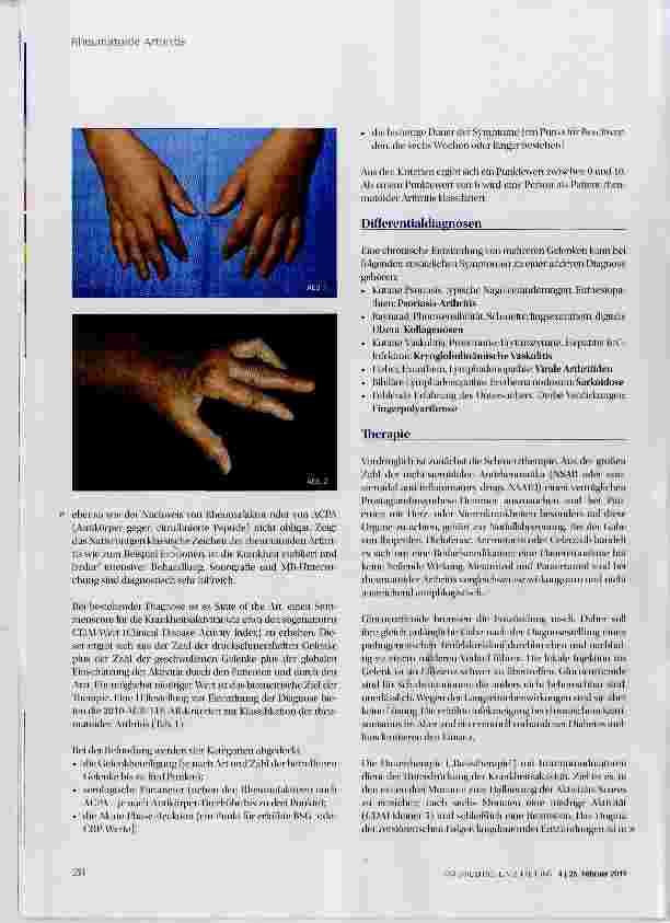 Vorschauseite 3: Rheumatoide Arthritis: aktuelle Therapie