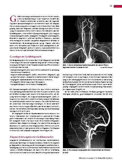Vorschauseite 2: Gefäßdiagnostik Bildgebung mit CT, MRT, Angiografie, Phlebografie und Sonografie