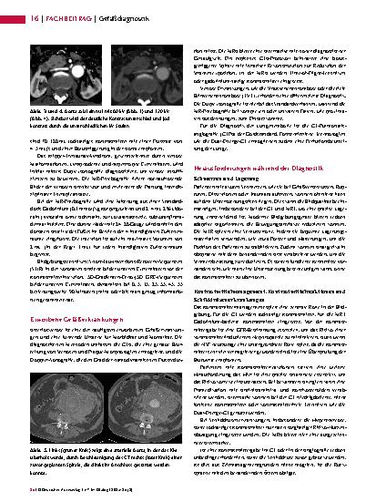 Vorschauseite 3: Gefäßdiagnostik Bildgebung mit CT, MRT, Angiografie, Phlebografie und Sonografie