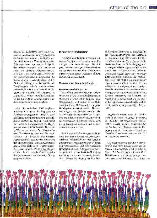 Vorschauseite 2: Netzhauterkrankungen