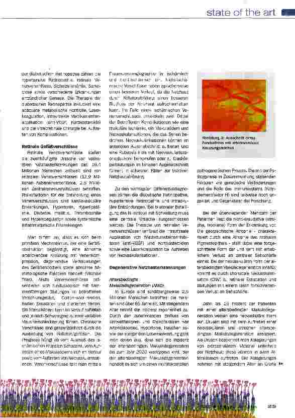 Vorschauseite 4: Netzhauterkrankungen