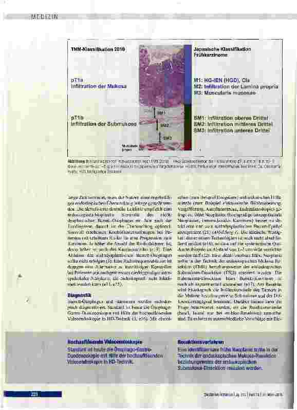 Vorschauseite 5: Epidemiologie, Diagnostik und Therapie des Barrett-Karzinoms