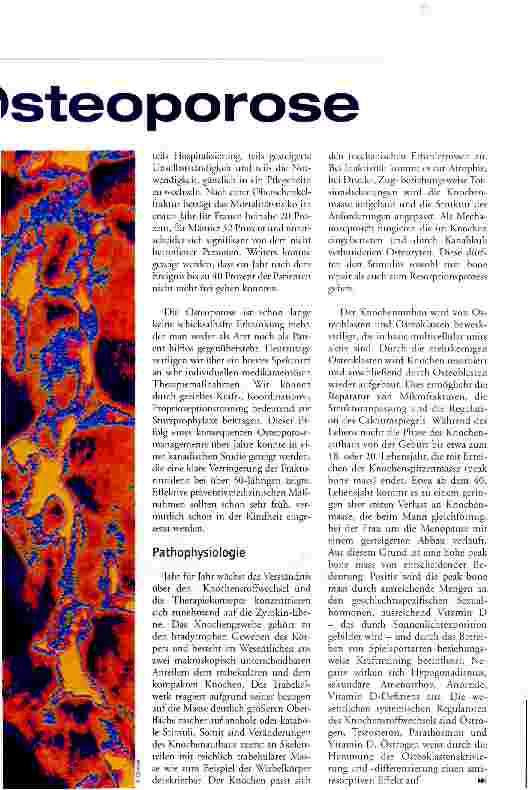 Vorschauseite 2: Management der Osteoporose