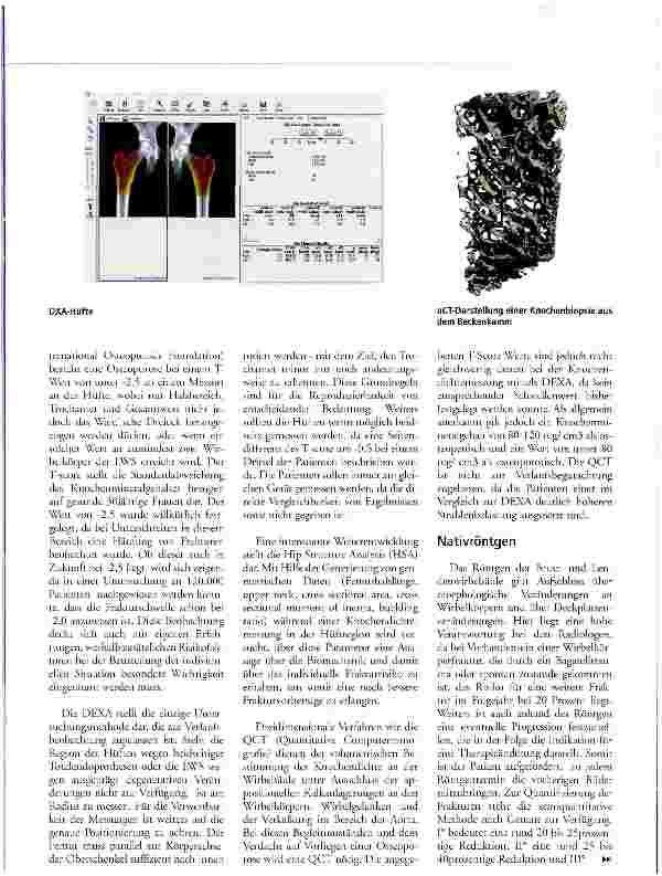 Vorschauseite 5: Management der Osteoporose