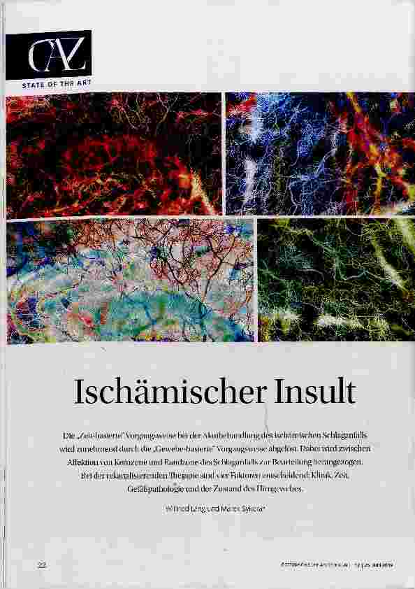 Vorschauseite 1: Ischämischer Insult