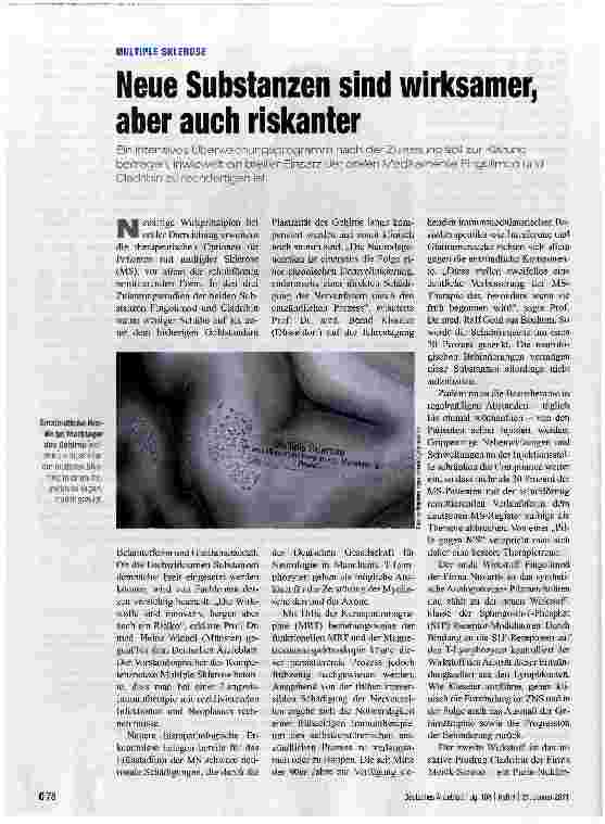 Vorschauseite 1: MULTIPLE SKLEROSENeue Substanzen sind wirksamer, aber auch riskanter