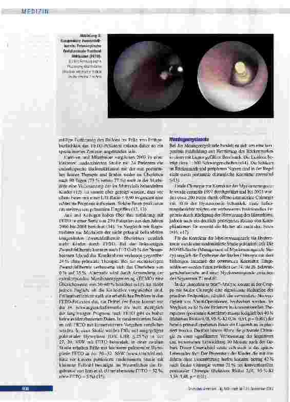 Vorschauseite 4: Möglichkeiten und Grenzen der intrauterinen Chirurgie