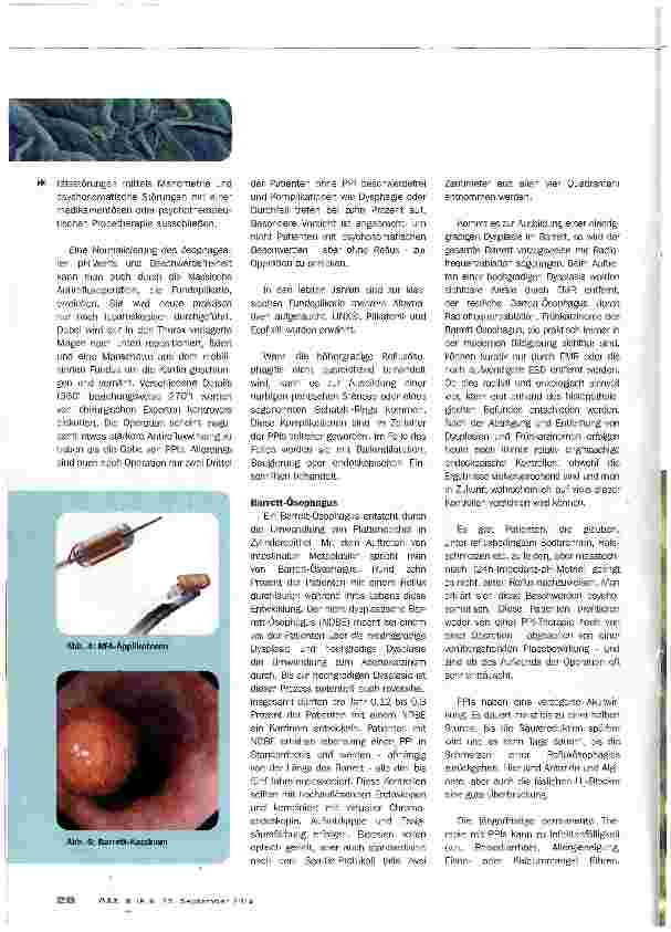 Vorschauseite 5: Refluxkrankheit