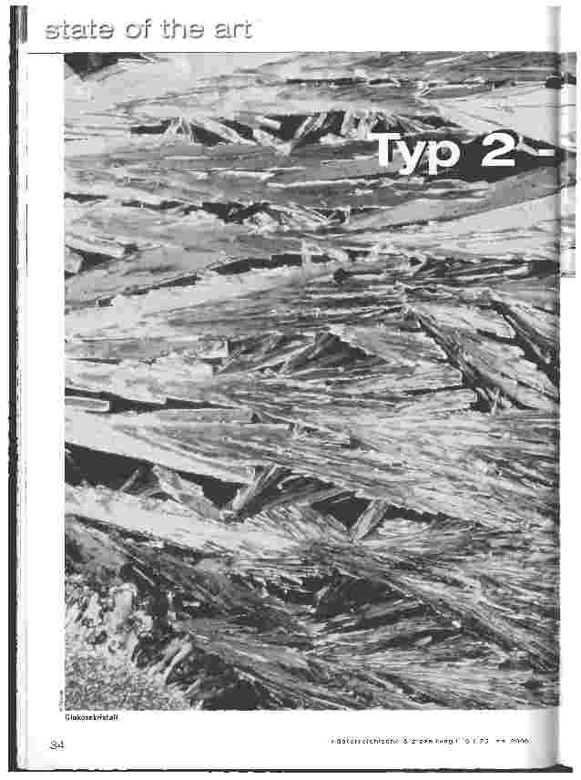 Vorschauseite 1: Typ 2 - Diabetes