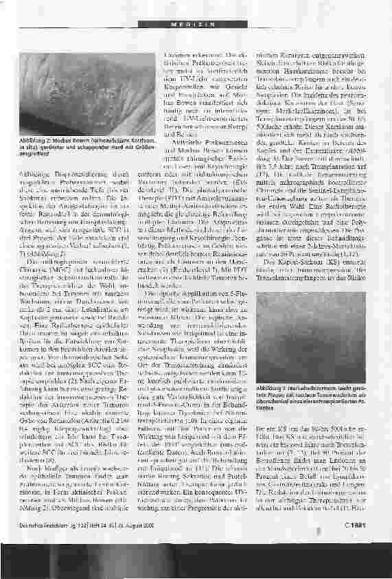 Vorschauseite 2: Hautveränderungen Transplantatempfängern