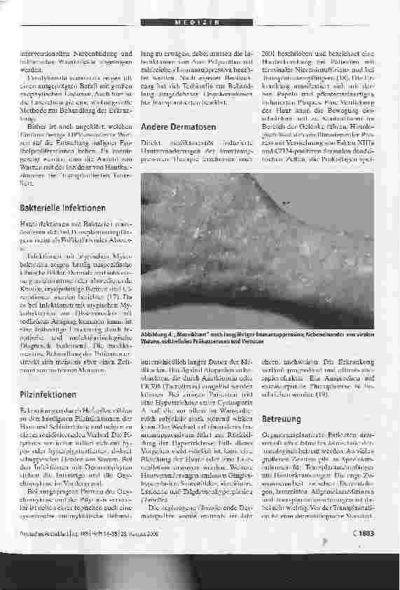 Vorschauseite 4: Hautveränderungen Transplantatempfängern