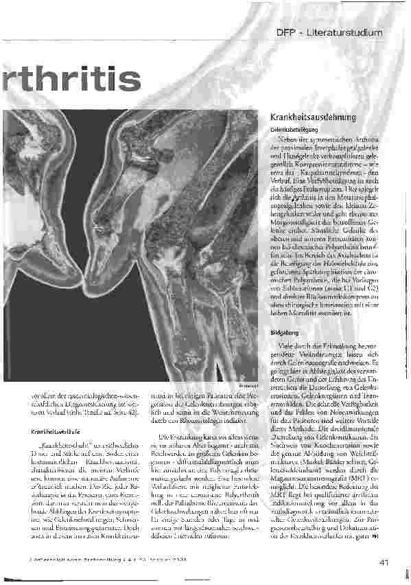 Vorschauseite 2: Chronische Polyarthritis