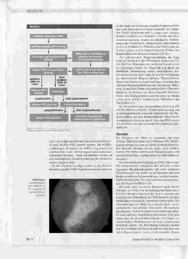 Vorschauseite 3: Das Masquerade-Syndrom