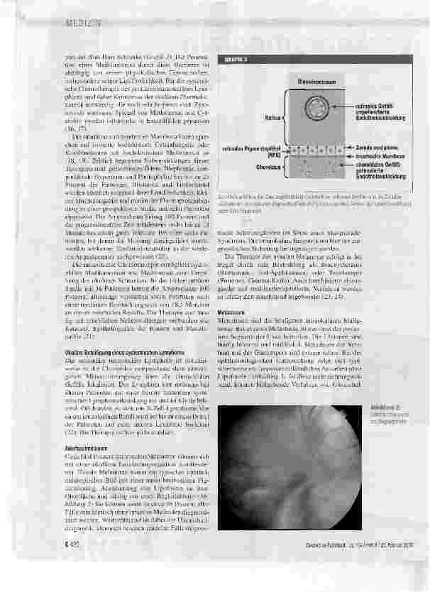 Vorschauseite 4: Das Masquerade-Syndrom