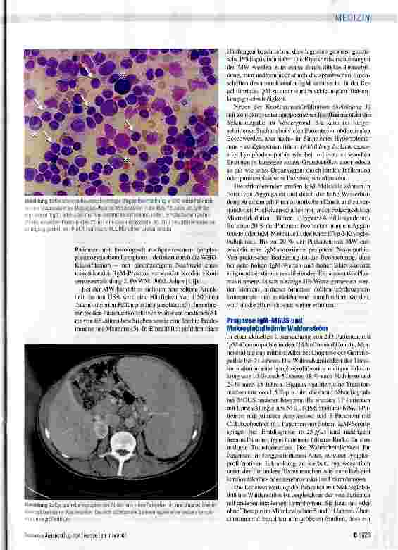 Vorschauseite 4: IgM-Gammopathie -Differenzialdiagnose, Klinik und Therapie