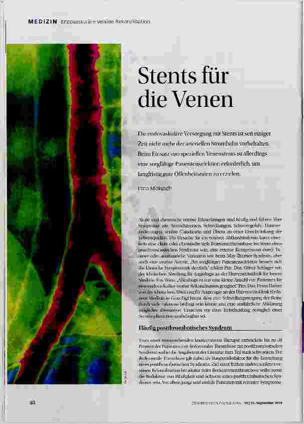 Vorschauseite 1: Stents für die Venen