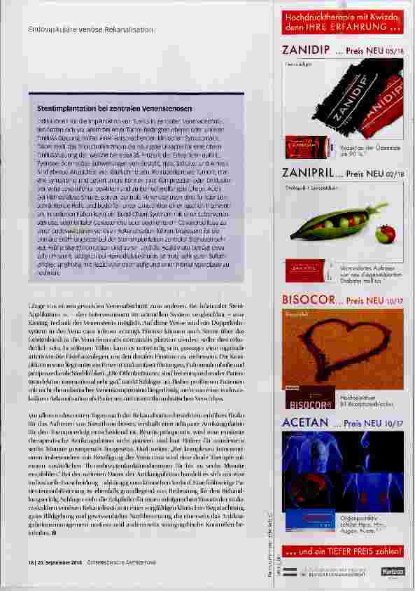 Vorschauseite 4: Stents für die Venen