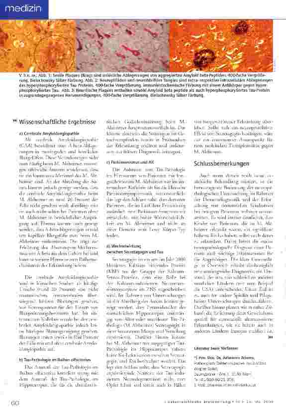 Vorschauseite 3: Neuropathologie bei demenziellen Erkrankungen