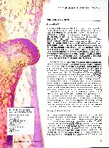 Vorschauseite 2: Arzneimittel - Induzierte Osteoporose