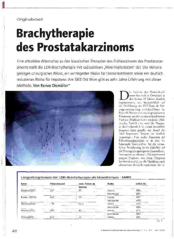 Vorschauseite 1: Brachytherapie des Prostatakarzinoms