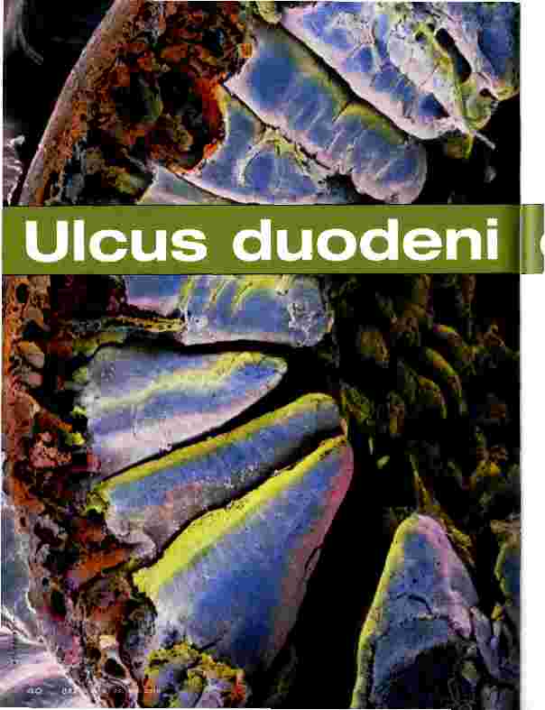 Vorschauseite 1: Ulcus duodeni et ventriculi