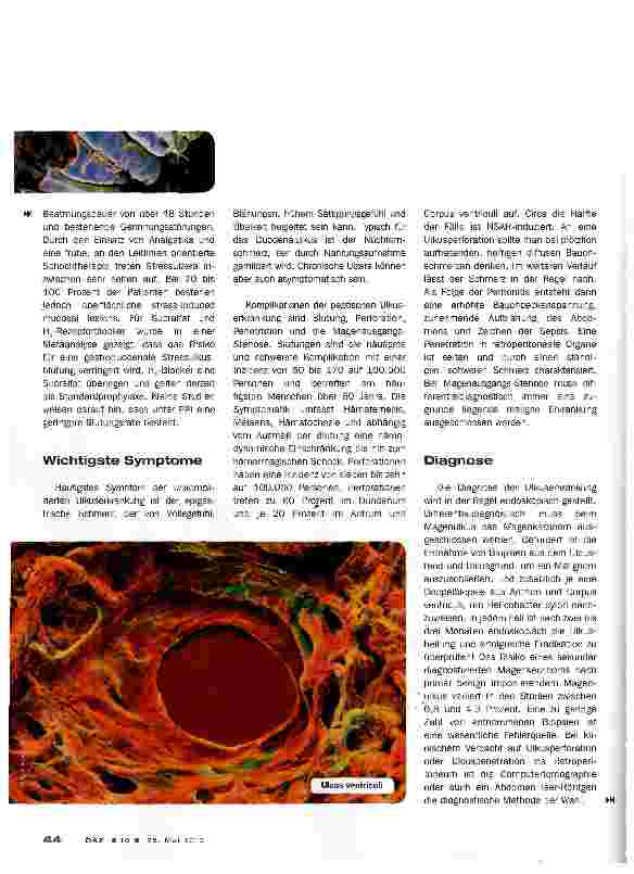 Vorschauseite 4: Ulcus duodeni et ventriculi