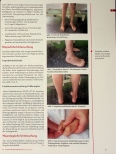 Vorschauseite 3: CRPS nach Tibiafraktur und Fasziotomie LQ Q- < QL LQ X Fallbeispiel zur leitliniengerechten Therapie