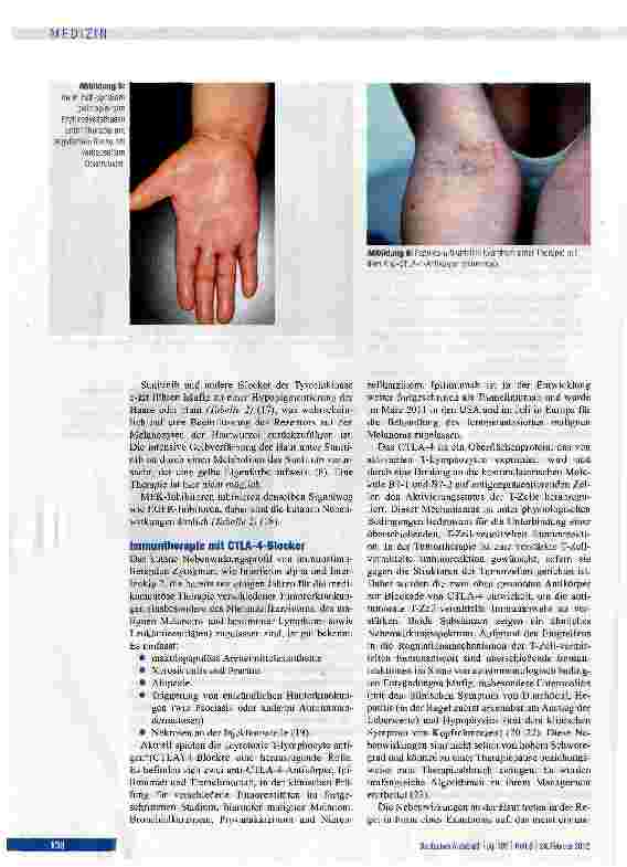 Vorschauseite 6: Kutane Nebenwirkungen von neuen medikamentösen Tumortherapien