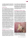 Vorschauseite 2: Forensische Entomologie: Wenn Insekten Verbrecher jagen