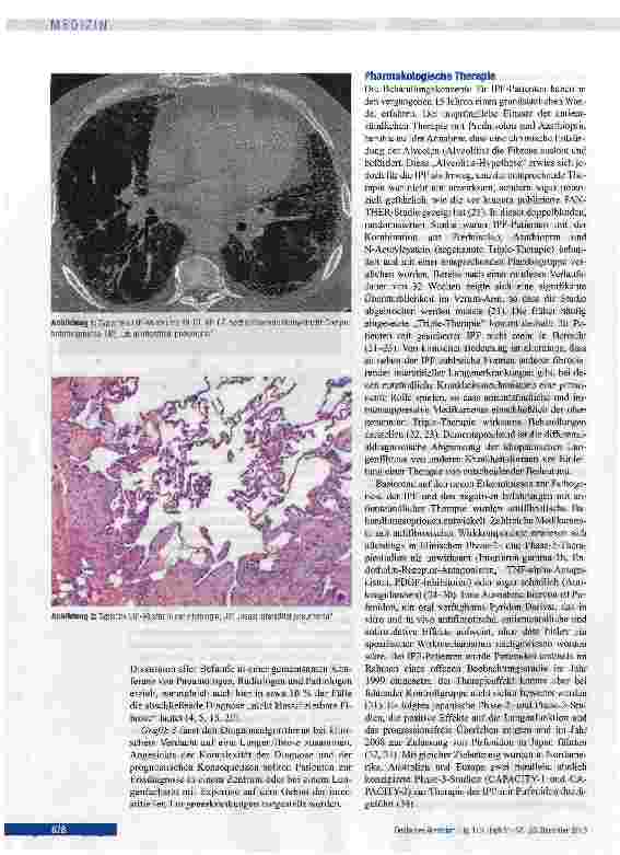 Vorschauseite 4: Diagnostik und Therapiemöglichkeiten bei idiopathischer Lungenfibrose