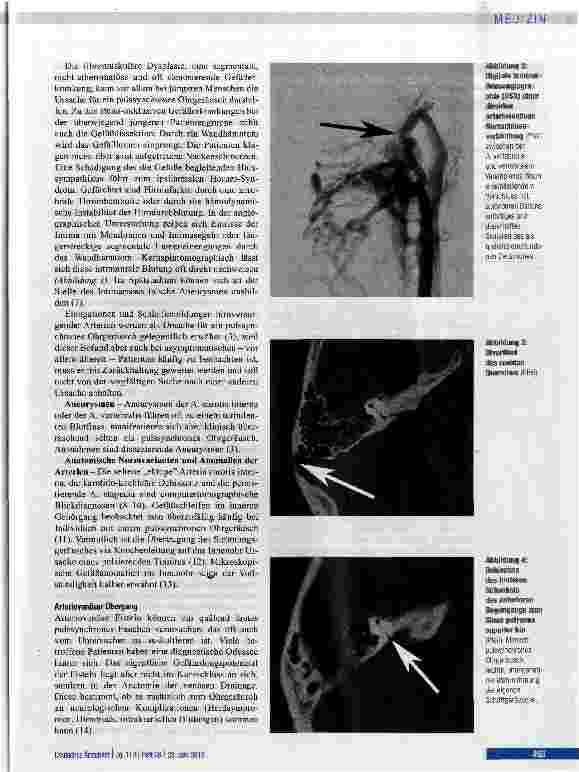 Vorschauseite 3: Leitsymptom pulssynchrones Ohrgeräusch
