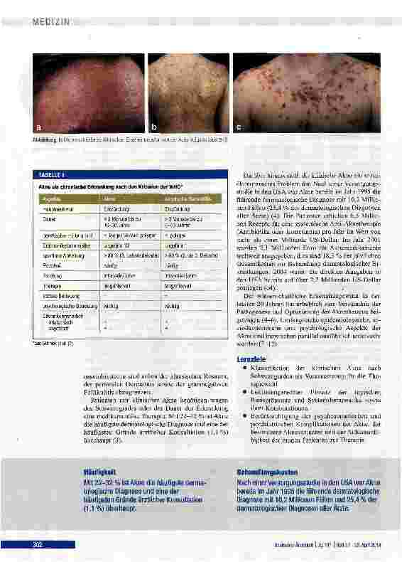Vorschauseite 2: Akne ist nicht gleich Acne vulgaris