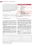 Vorschauseite 3: Das pathologische EKG: Ventrikuläre Herzrhythmusstörungen