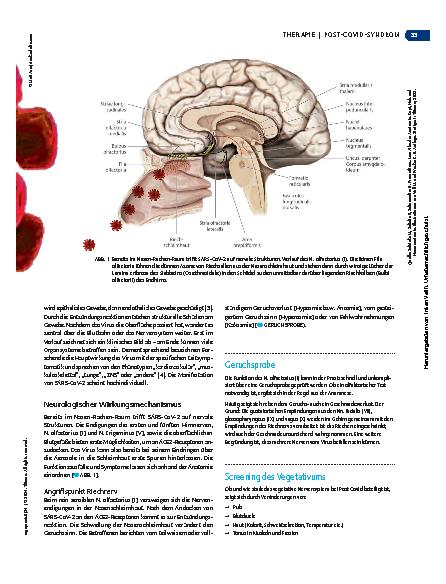 Vorschauseite 2: Neurologische Leitsymptome bei Post-Covid