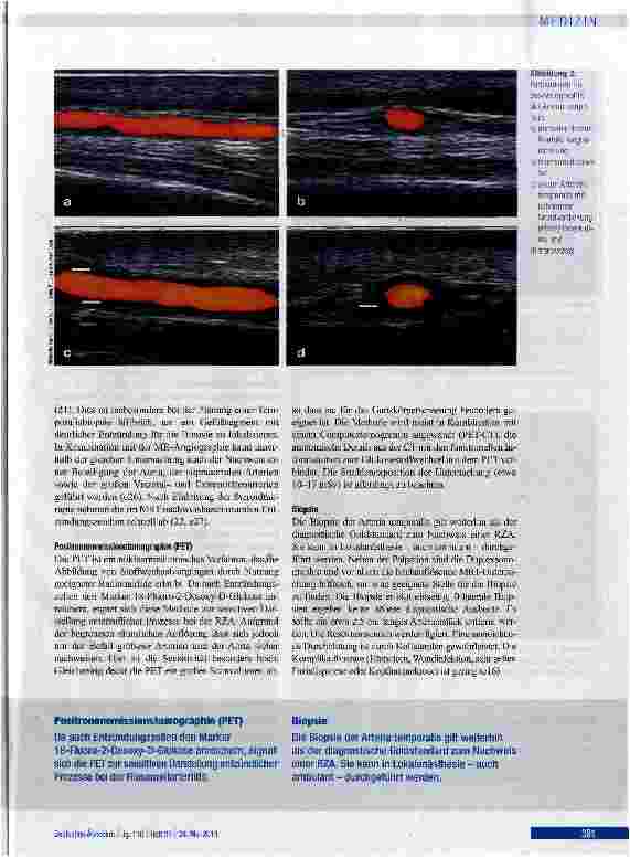 Vorschauseite 6: Diagnose und Therapie der Riesenzellarteriitis